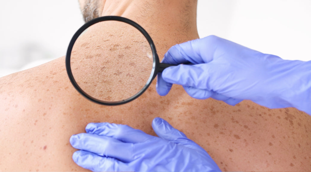 Truth Bombs Part 2: More Myth Busting from Our Dermatologist Founder