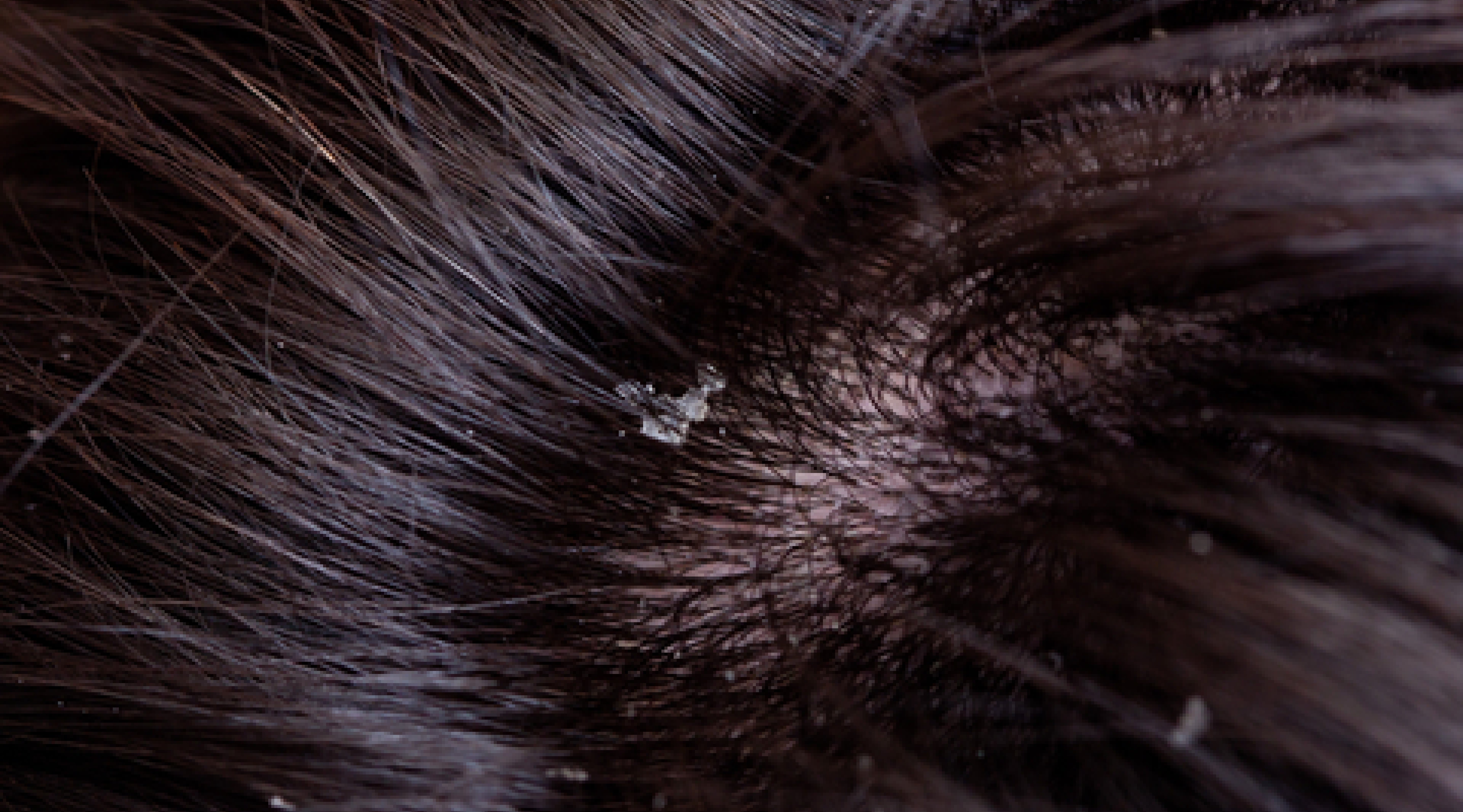 Solving common scalp concerns | Dermatologist-designed care